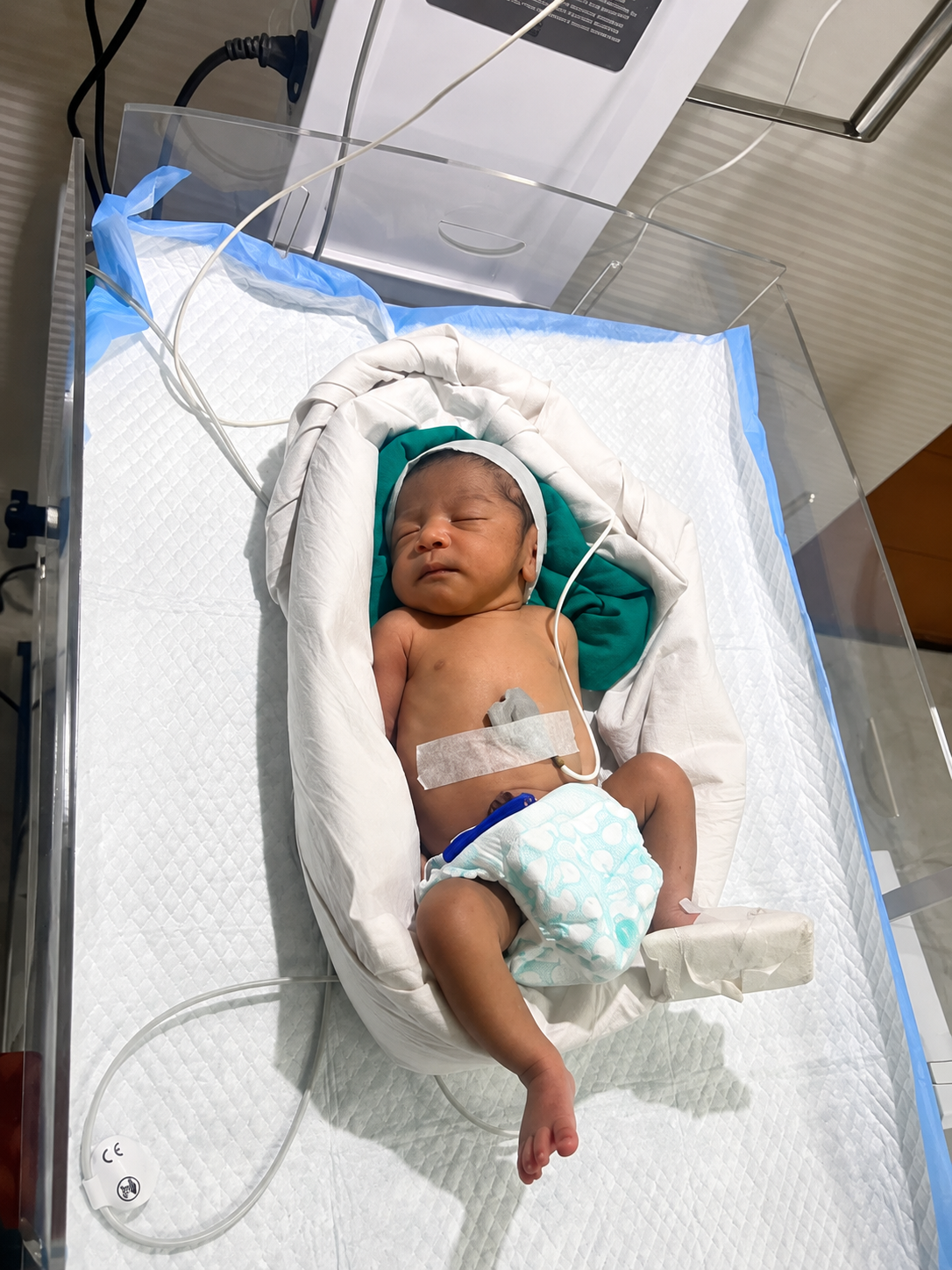 NICU newborn care facility at Umang Medical Centre