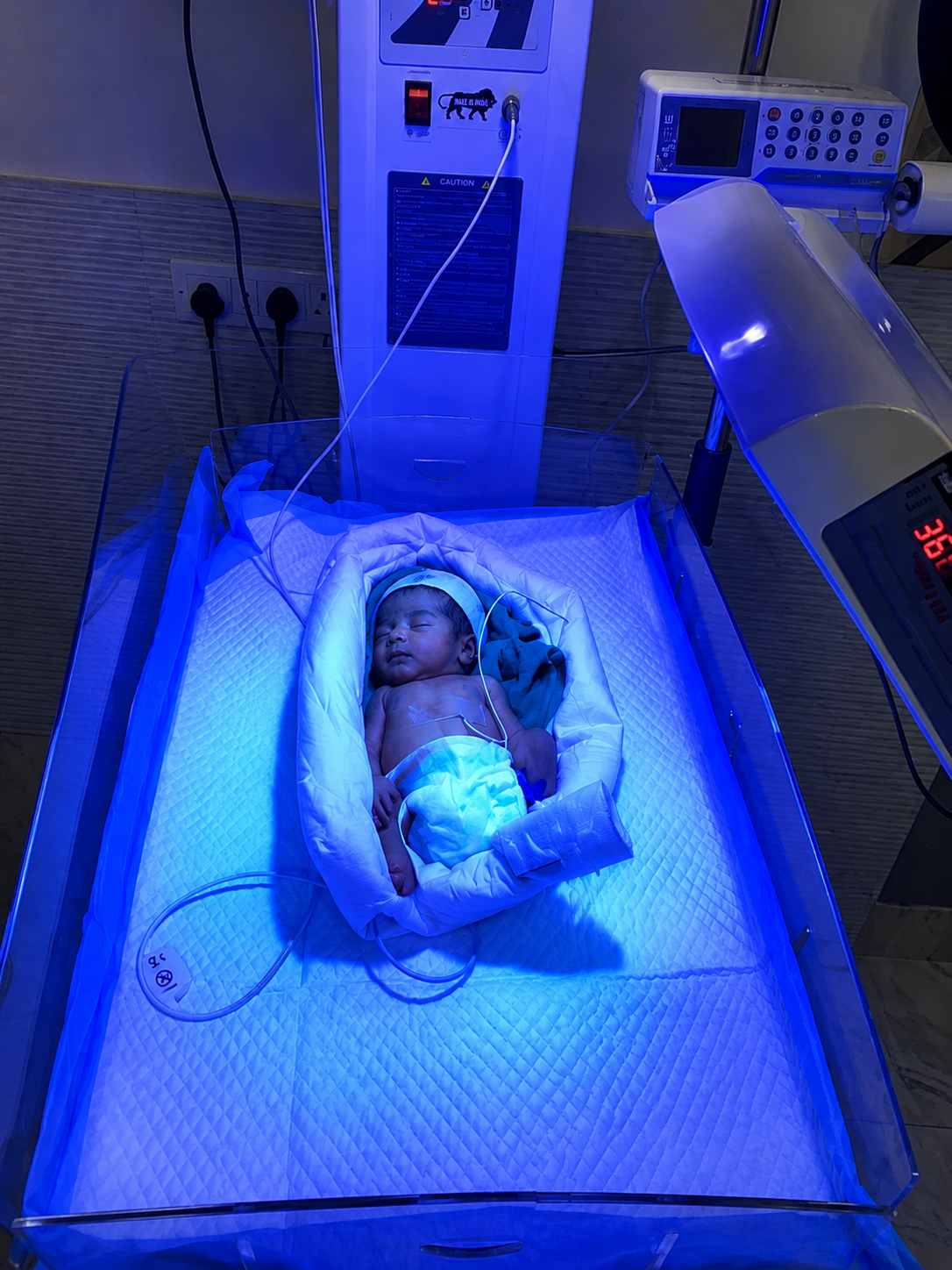 Phototherapy treatment for a newborn with neonatal jaundice at Umang Medical Centre
